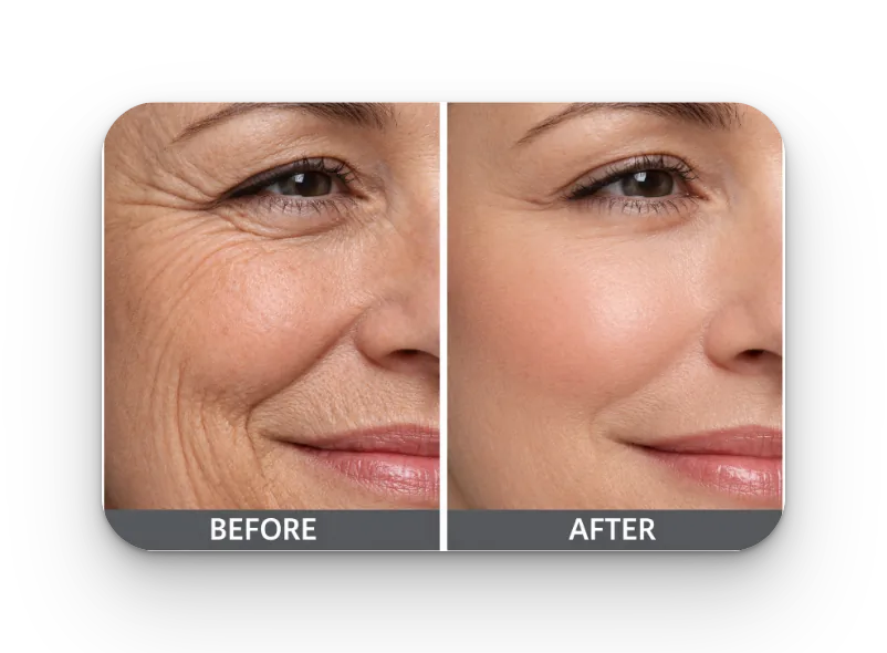 Before and After Results