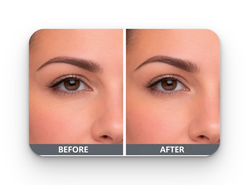 Before and After Results