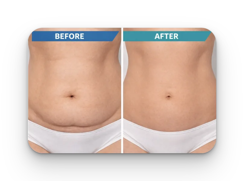 Before and After Results