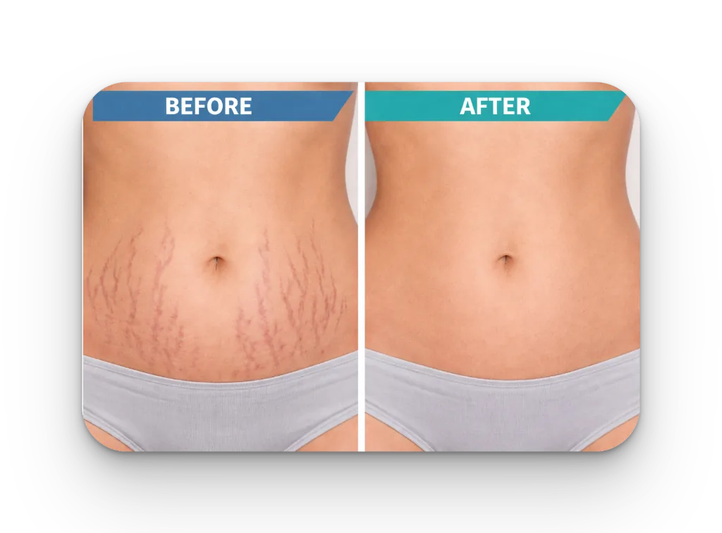 Before and After Results