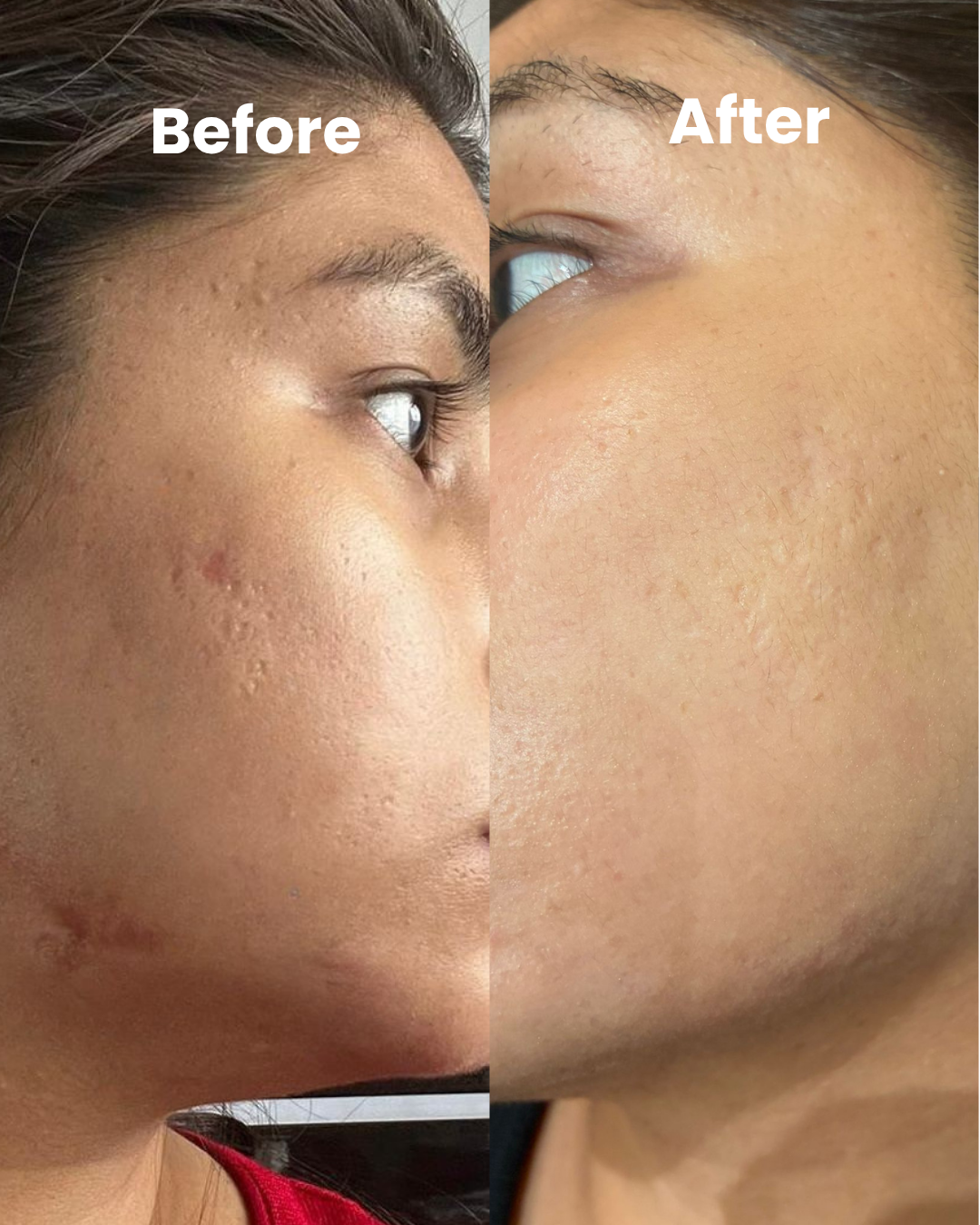 Before and After Results