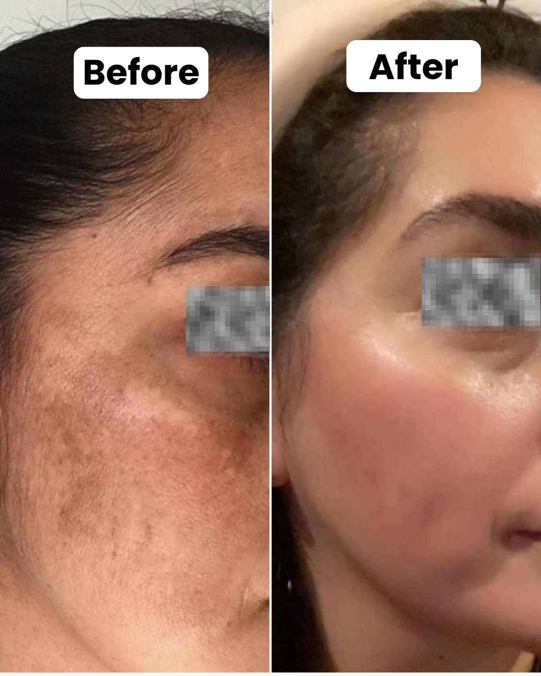 Before and After Results