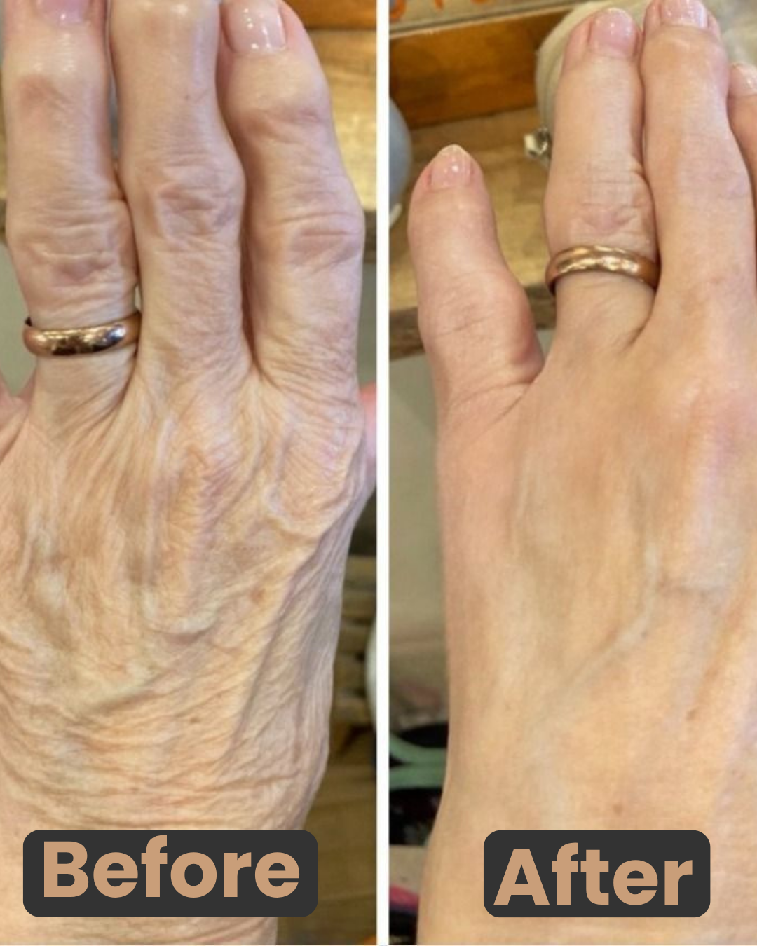 Before and After Results