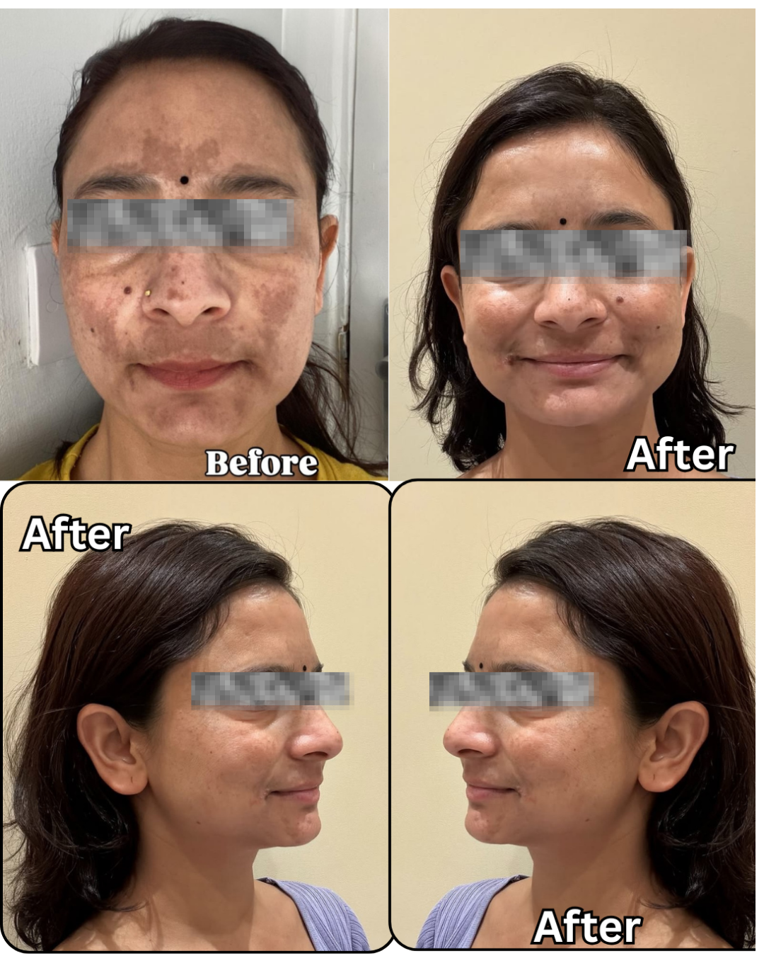 Before and After Results