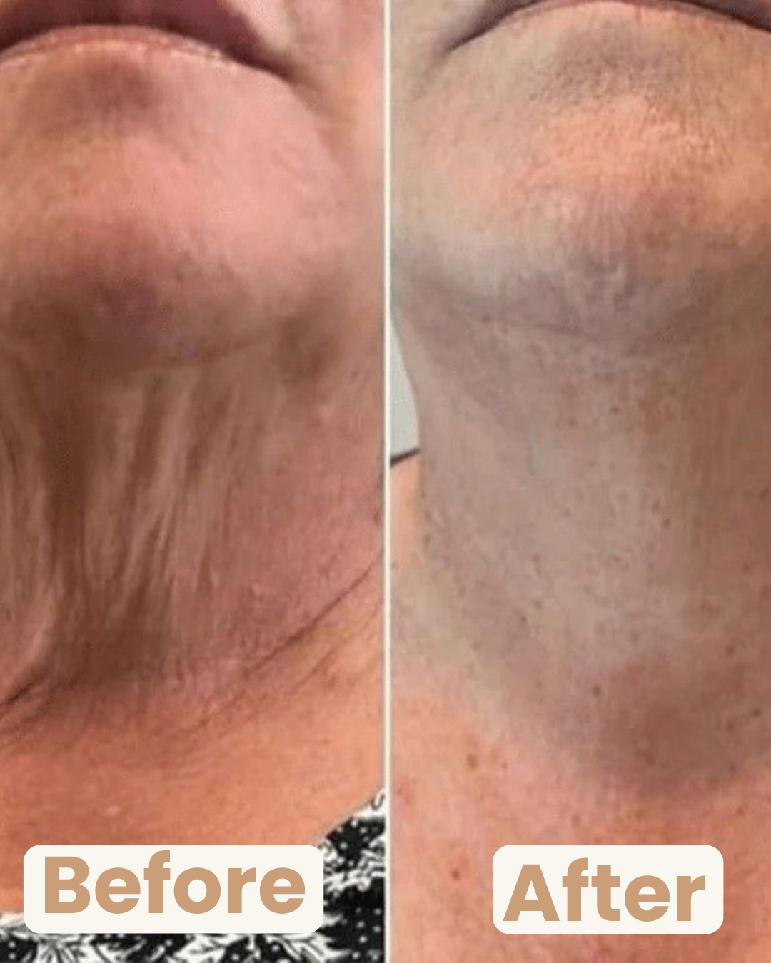 Before and After Results